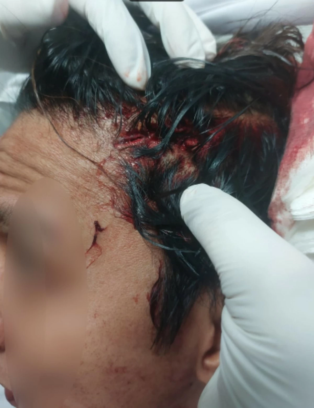 Rhino, the victim with head injury (Photo from Pasay City Police)