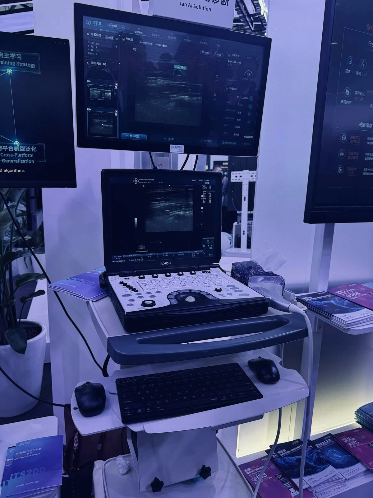 Huawei’s AI-driven healthcare solutions on display at MWC 2025 include real-time diagnostic imaging systems—designed to assist in early detection and improve clinical accuracy through intelligent data interpretation.