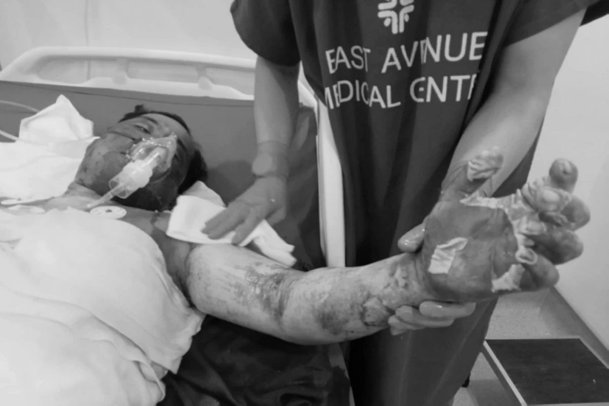 James Villaruel being treated for severe burns in a hospital (Photo from Bhabie Garmino) 