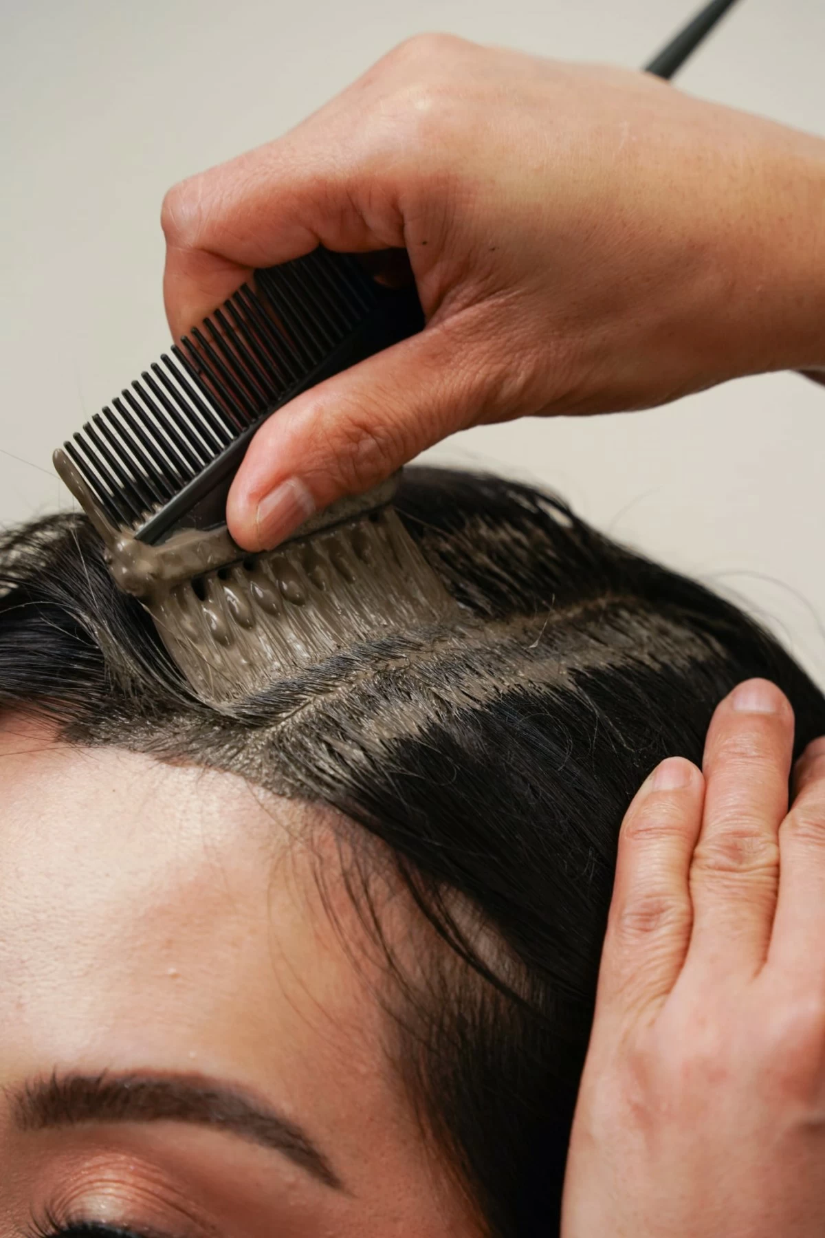 Known for its holistic approach, Meinas Scalp Solutions uses all-natural, herbal formulations.
