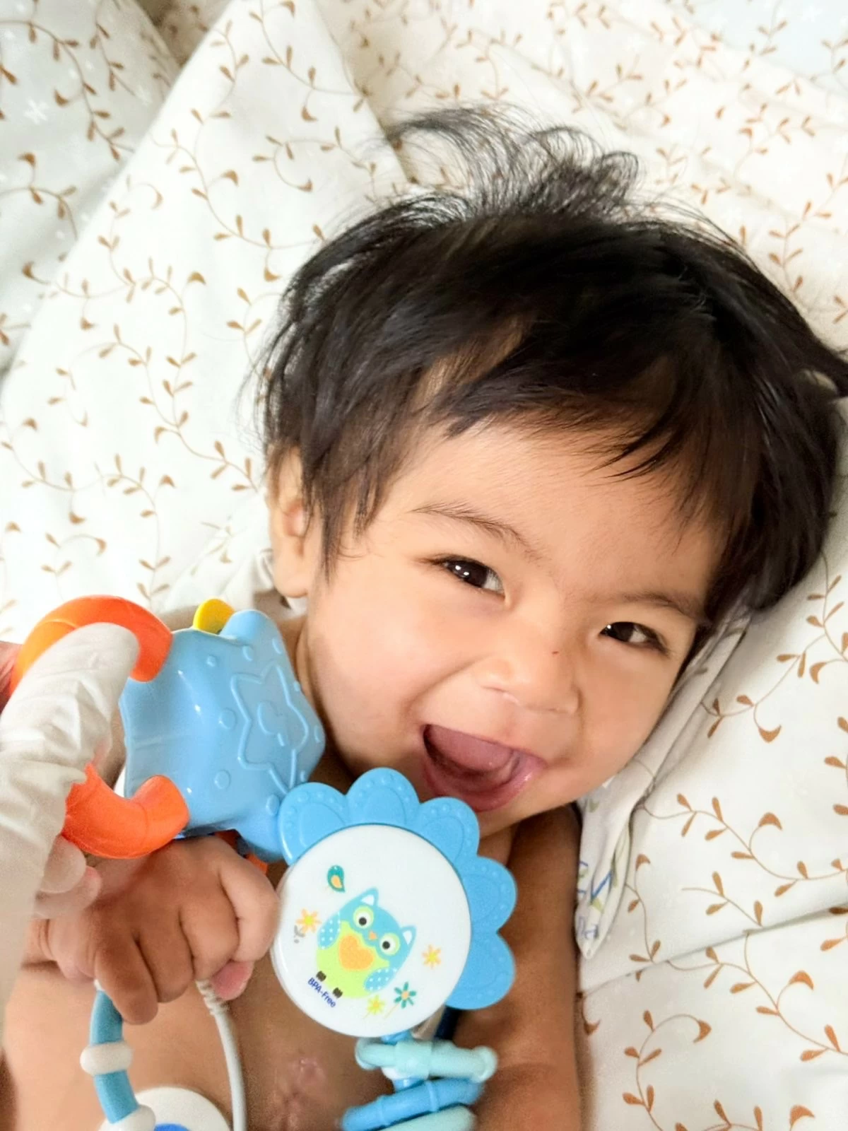 Clyden, the youngest among the three patients, shares a playful moment just weeks after his procedure.