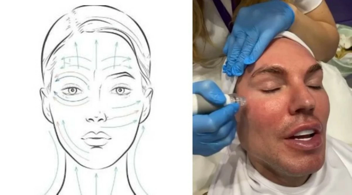 STEP BY STEP A patient undergoes the AquaB cleansing technique.