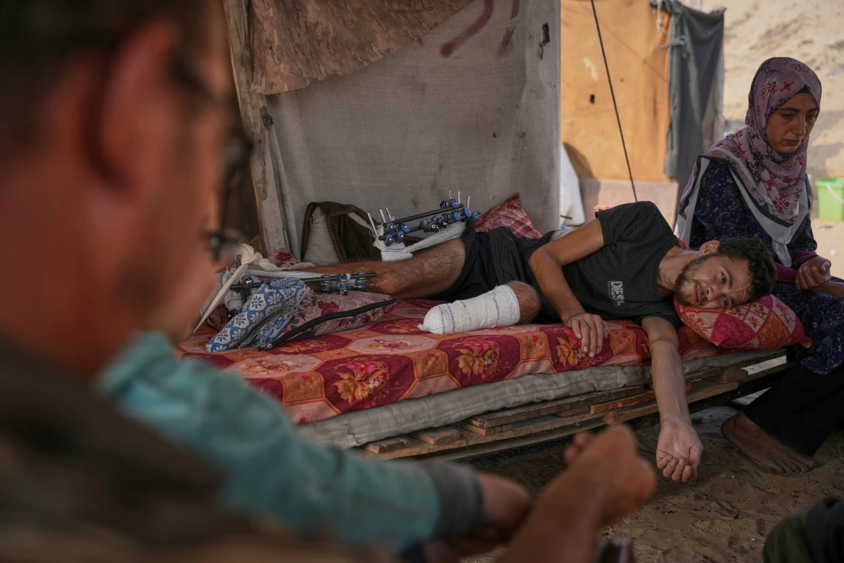 Yassin Marouf, 23, who lost his left foot and suffered a severe injury to his right leg after being hit by Israeli shelling in May, lies in a tent surrounded by his family in Zawaida, central Gaza, Thursday, Nov. 6, 2025. (AP Photo/Abdel Kareem Hana)