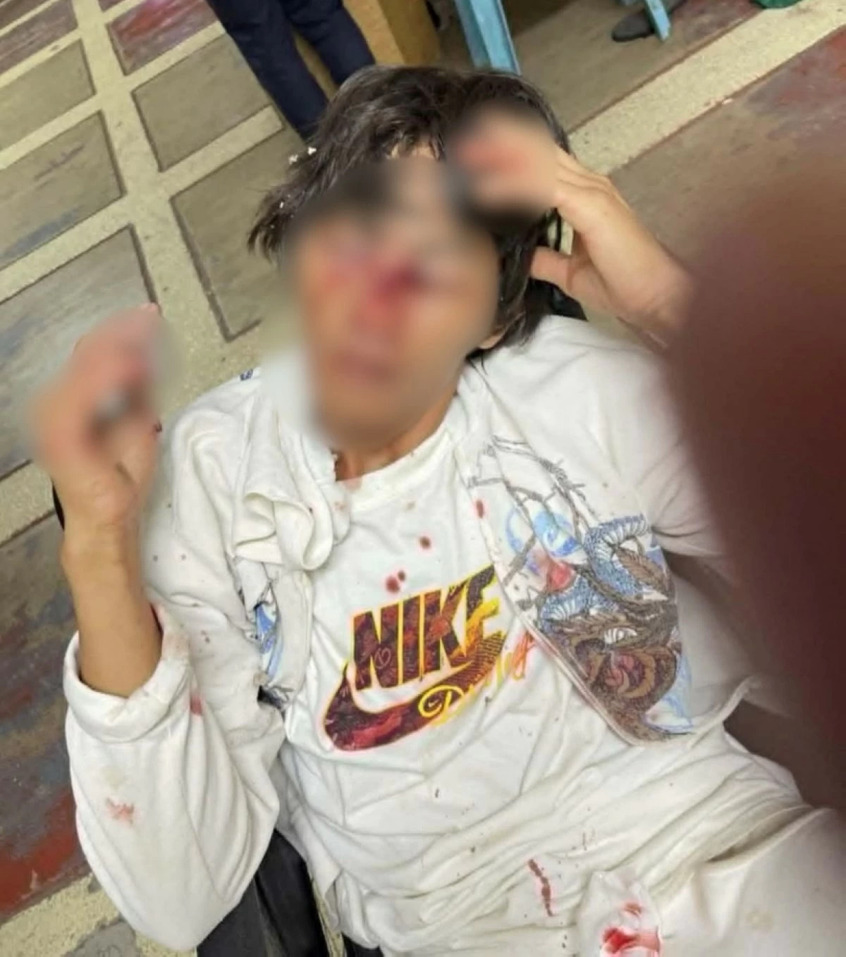 The injured 24-year-old man in Muntinlupa (Photos from Mayor Biazon's Facebook account) 