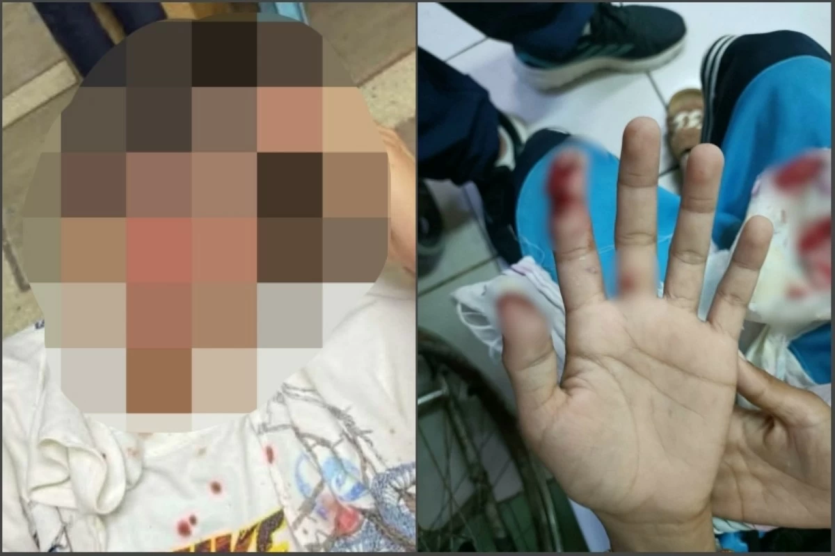 The 24-year-old man (left) and an 11-year-old boy injured by firecrackers in Muntinlupa (Photos from Mayor Biazon's Facebook account) 