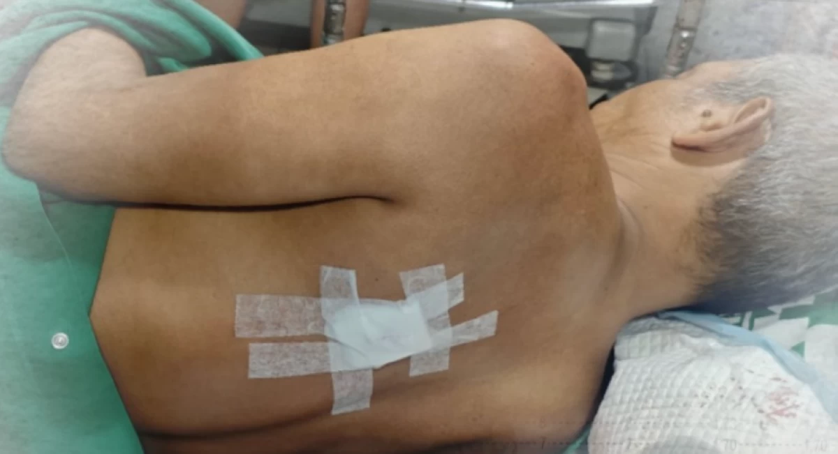 Pedicab driver who was hit by a stray bullet in Cavite City on March 29 (Photo from Cavite PPO/MANILA BULLETIN)