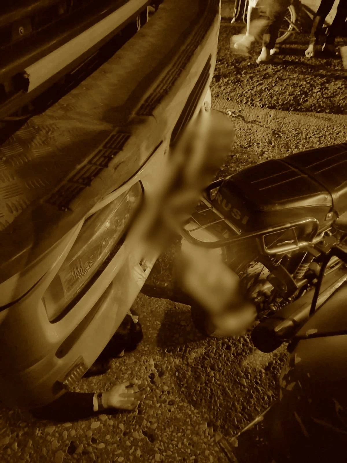 Woman loses leg in Tondo crash after falling from tricycle