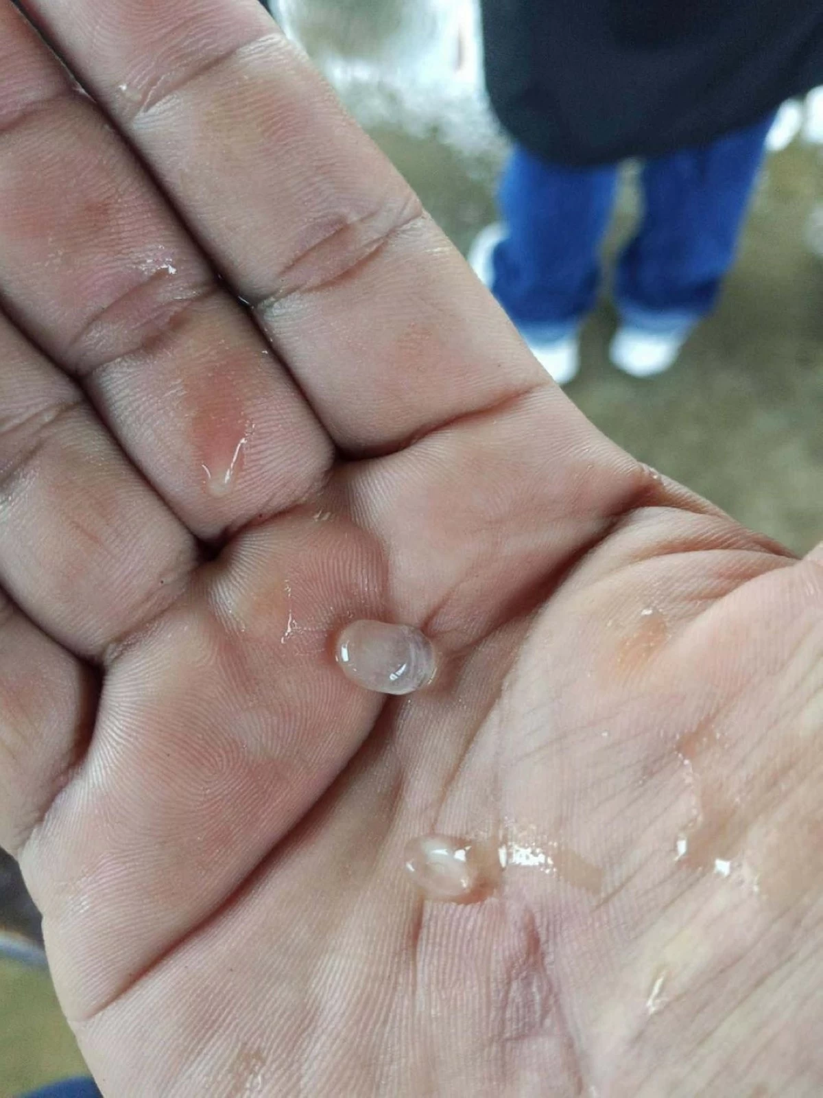 
A HAILSTORM hits La Castellana, Negros Occidental on Thursday, June 18. (MDRRMO)

