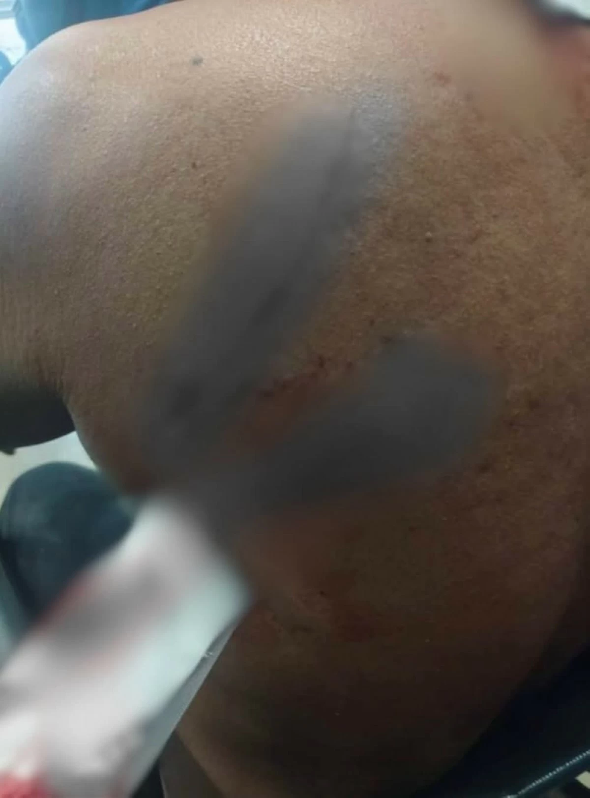 A 42-year-old construction worker shows the stab wound on his cheek after a confrontation with his co-worker in Barangay Greater Lagro, Quezon City, on Thursday. (Photo courtesy of Pasong Putik Police Station 16)
