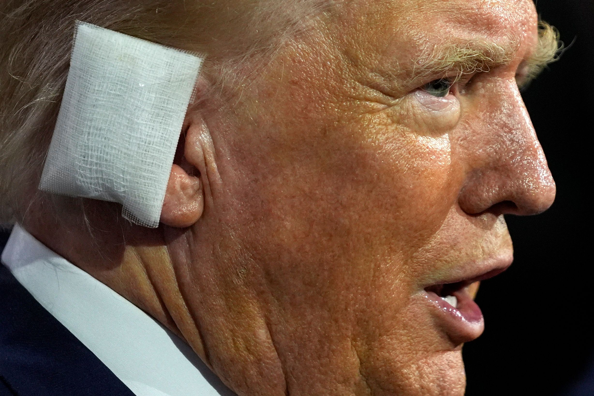 17trumps bandaged ear.jpg