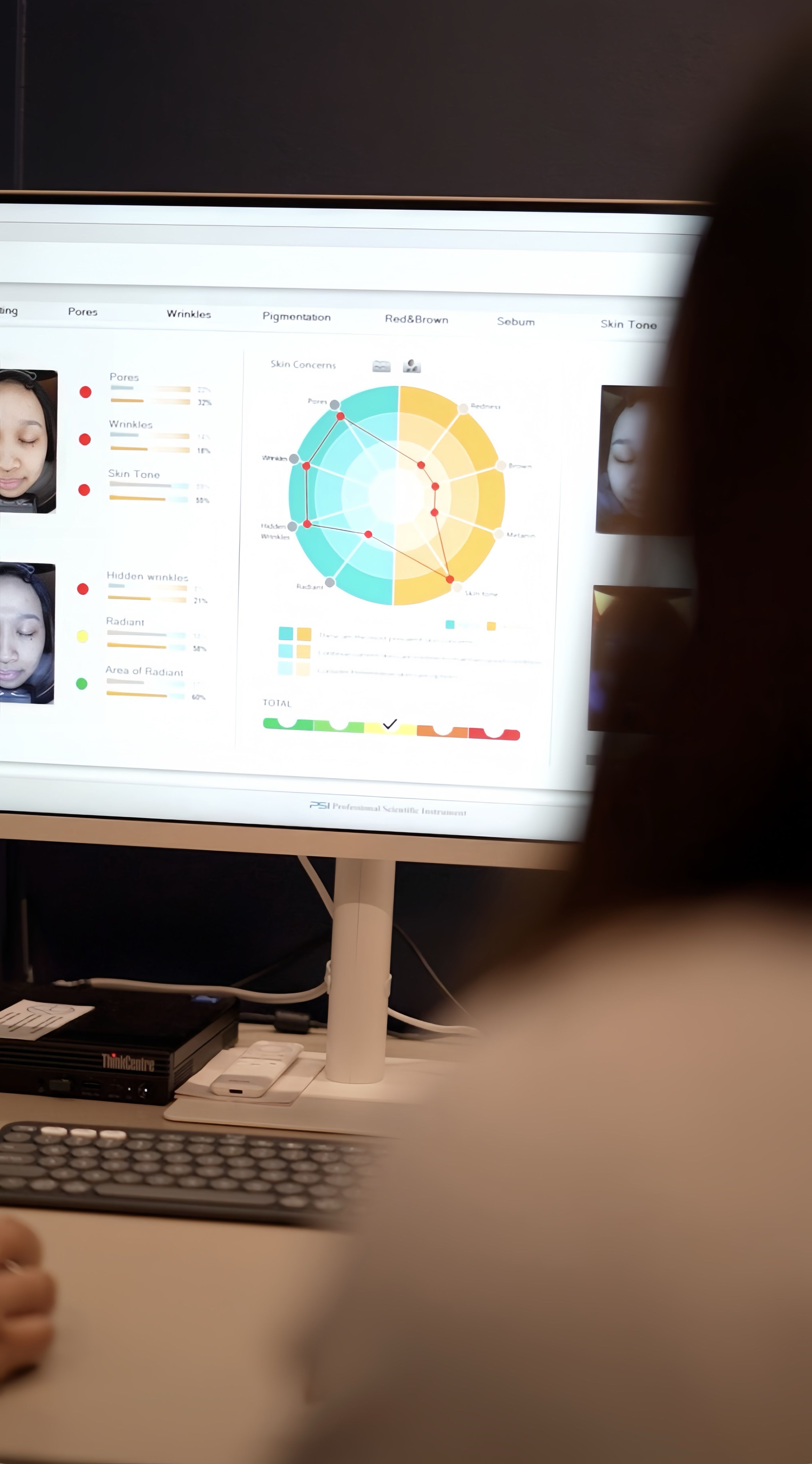 Remedy Skin Analyzer 6.JPG