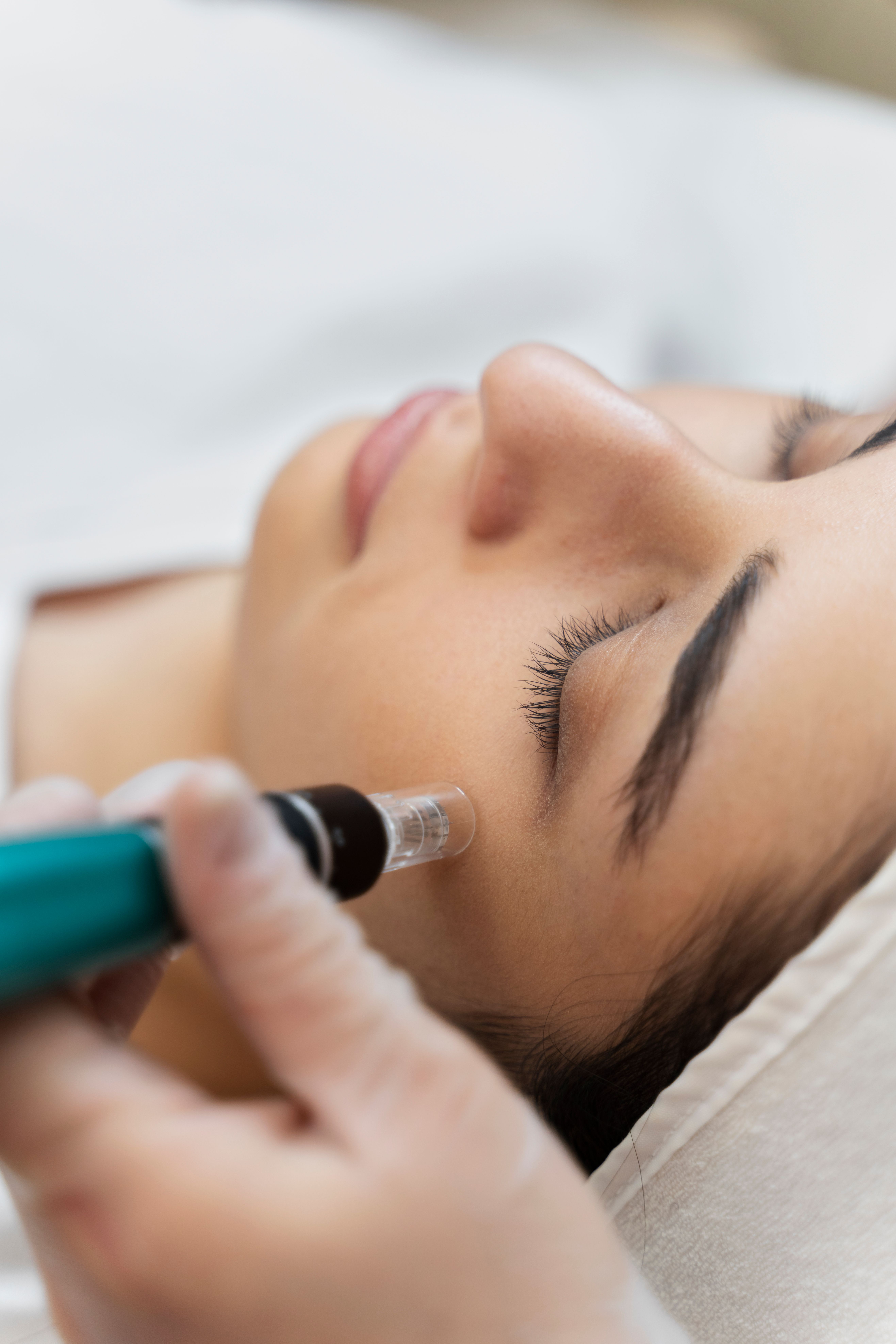 person-getting-micro-needling-beauty-treatment.jpg